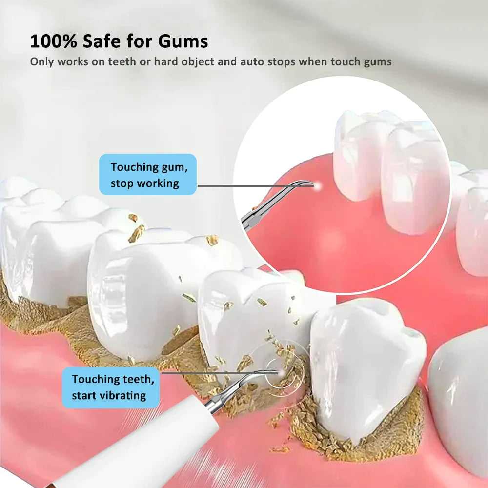 Nettoyeur Dentaire Électrique Ultrason Plastique Compact Pour Un Sourire Éclatant-2