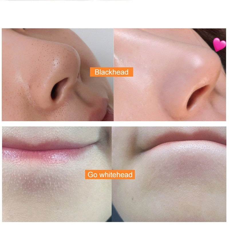 Masque Peel-off à la vitamine C et au miel